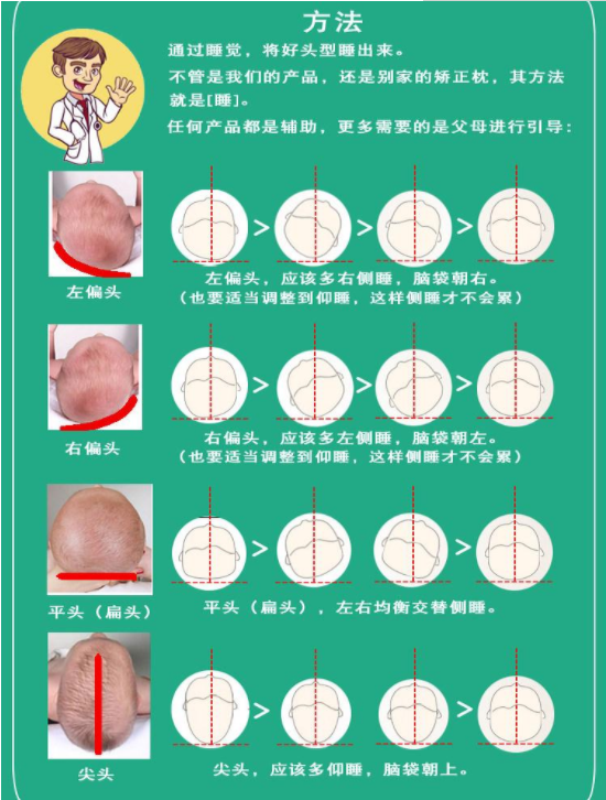 衡阳月嫂推荐的婴儿头型矫正方法